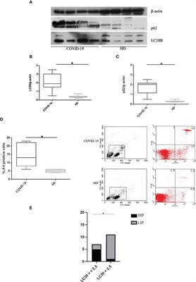 Autophagy Hijacking in PBMC From COVID-19 Patients Results in Lymphopenia